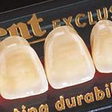 Műfog Goldent Exclusive front (6 db fog) Műfog Goldent Exclusive front (6 db fog)